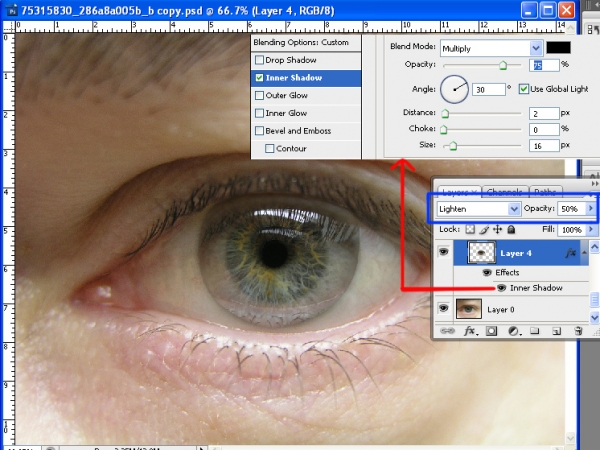 Creation of eye within eye: Step 2